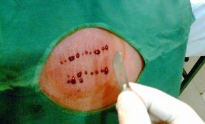 0lxvaeyvhopjtxmx8m5b